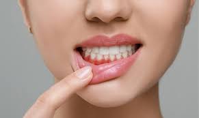how do you get rid of swollen gums fast