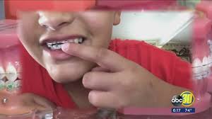 Fake braces braces cost dental braces teeth braces braces girls black braces getting braces ohio lip art. Diy Braces Becoming A Troubling Dental Trend Among Kids And Young People Abc30 Fresno
