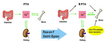 Medical Management Of The Postoperative Bariatric Surgery