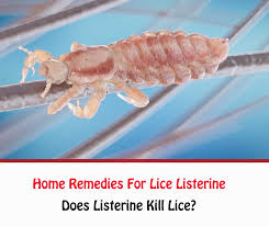 home remes for lice listerine
