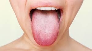 swollen taste buds possible causes