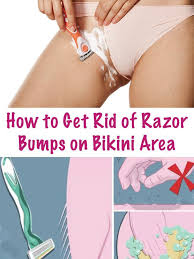 Confused about bikini hair removal? Pin On Healthy Life