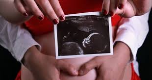 Pemeriksaan ultrasonografi (usg) adalah hal yang sangat dianjurkan untuk perempuan hamil. 6 Hal Yang Harus Dipersiapkan Saat Pertama Kali Melakukan Usg Popmama Com