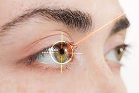 cataract surgery recovery