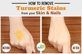 how to remove turmeric stains from skin