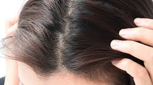 troubled by pimples on your scalp here