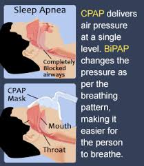 bipap vs cpap differences pros and