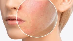 allergic reactions main cause in skin