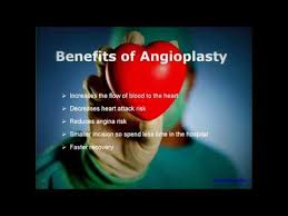 Indian Diet After Angioplasty Youtube