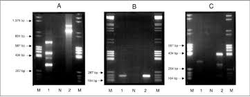 gel electropsis in 1x tae buffer