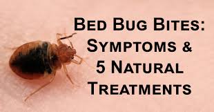 bed bug bites symptoms 5 natural