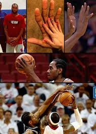 Kawhi comes at #9 in the total size list of nba players' hands, just in front of wilt chamberlain, the dunk machine. Ballislife Com On Twitter Kawhi Leonard S Hands Are 9 75 Inches In Length And 11 25 Inches In Width Average Adult Male Length 7 44 Inches
