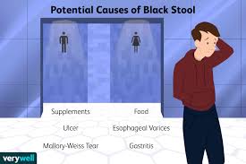 black stool causes and when to see a