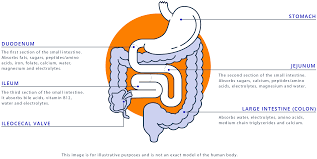 what is short bowel syndrome sbs