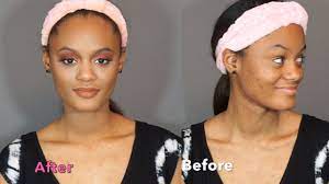 sweet 16 makeup transformation acne