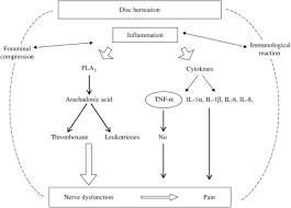 Sciatica A Review Of History Epidemiology Pathogenesis