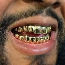 gold teeth in oakland ca