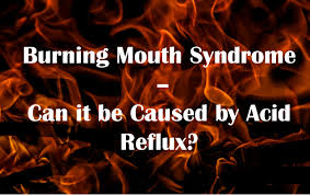 burning mouth syndrome can it be