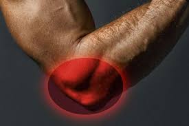 is there a cure for tennis elbow pain
