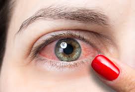 conjunctivitis or pink eye causes