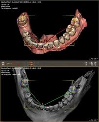 dental surgery by owandy radiology