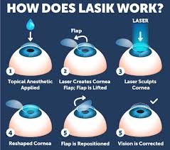 That is because, the body is still changing and even the eyes are still trying to get their correct places; Lasik Surgery Recovery Process Wolfe Eye Clinic