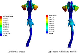 Which four body systems interact to allow a person to sneeze? Study Of The Sneezing Effects On The Real Human Upper Airway Using Fluid Structure Interaction Method Springerlink