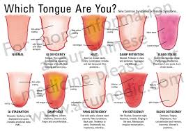 Basic Tongue Diagnosis Chart Acumedic Clinic