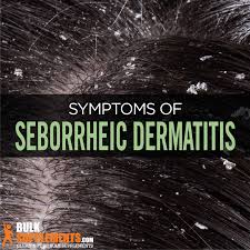 seborrheic dermais symptoms causes