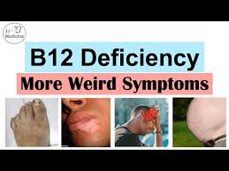vitamin b12 deficiency weird symptoms