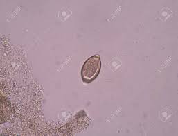 Auf einzellige parasiten, welche den hauptteil der parasiten im darm ausmachen, wird in der regel nicht getestet. Egg Parasiten Im Stuhl Prufung Lizenzfreie Fotos Bilder Und Stock Fotografie Image 49788063