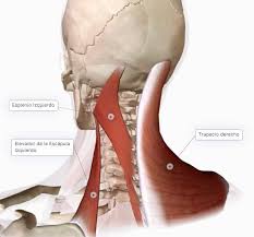 Learn about cervical spinal cord injury symptoms and recovery at shepherd center. Musculatura De La Region Cervical I Musculatura Dorsal Paradigmia