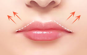 lip lift surgery grand plastic surgery