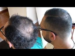 how to cut and fade balding hair you
