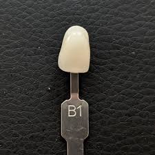 b1 tooth color photo comparison guide