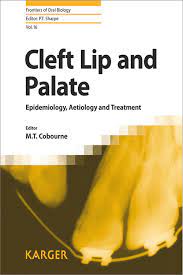 cleft lip and palate by m t cobourne