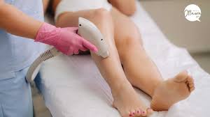 the 9 best laser hair removal services