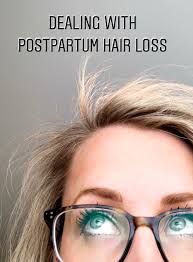 franish dealing with postpartum hairloss
