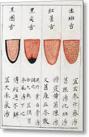 Chinese Tongue Diagnosis Chart 1341 Metal Print