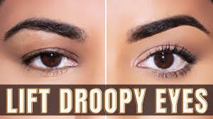 how to instantly lift droopy eyelids