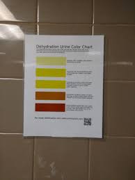 My Workplace Has Urine Color Charts Over The