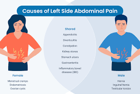 causes of abdominal left side pain