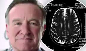 Robin williams was an american actor best known for his performance in the movie 'good will hunting'. Robin Williams Final Days Explored In New Documentary Investigating His Neurodegenerative Disorder Daily Mail Online