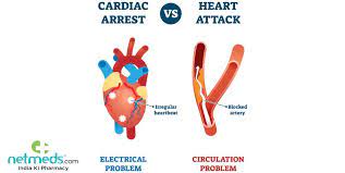 Cardiac arrest symptoms and causes. Cardiac Arrest Causes Symptoms And Treatment