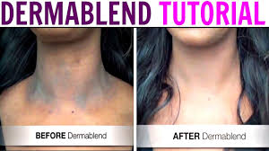 cover scars tattoos dark spots with