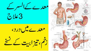 how to cure stomach ulcer home remes