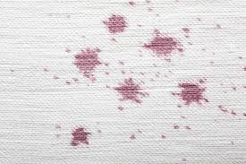professional stain removal services to