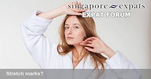stretch marks singapore expats forum