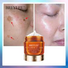 How to safely use freckle removal creams. Breylee Vitamin C Whitening Facial Cream 20 Vc Fade Freckles Remove Dark Spots Shopee Malaysia