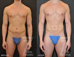 male body contouring plastic surgery